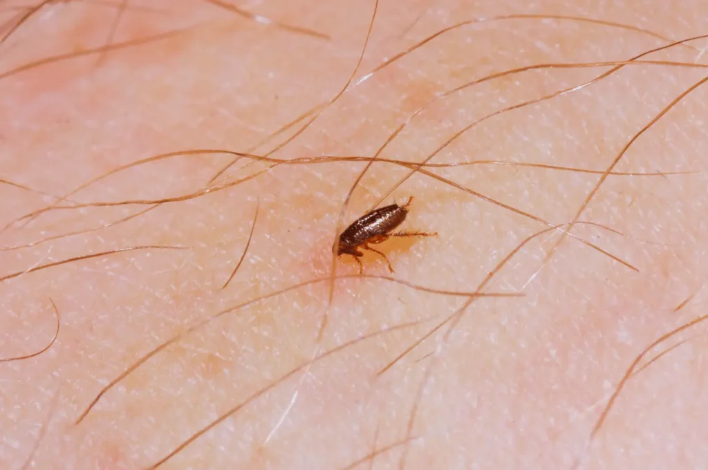 How to Get Rid of Fleas on Dogs